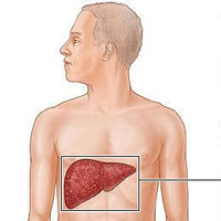 شناخته شده‌ترین راهکار درمانی کبد 